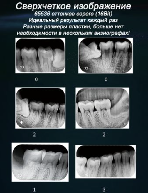 VistaScan Mini View, Durr Dental, Trident, KaVo Scan eXam One, Satelec Acteon Group,Беспроводной визиограф, сканер фосфорных пластин, визиограф купить в Алматы, VRN EQ 600 купить в Казахстане, визиограф для стоматологии 